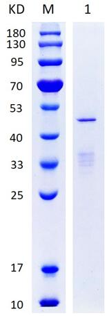 12% SDS-PAGE analysis profile of purified Human DNM2 protein (a.a.533-866) (CBB stained).<br />Lane M: Protein Marker Lane 1: Elution (0.4 ug protein loaded)